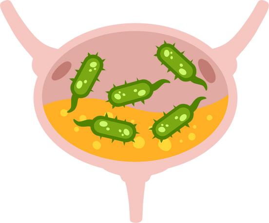 Virus in bladder